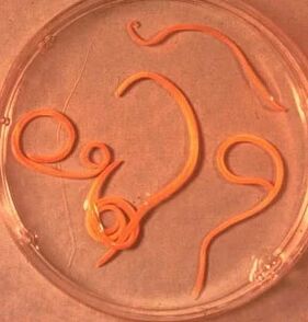 Paraziti človeka Ascaride