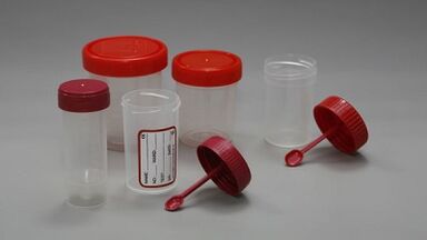 Ako sa pripraviť na test parazitov