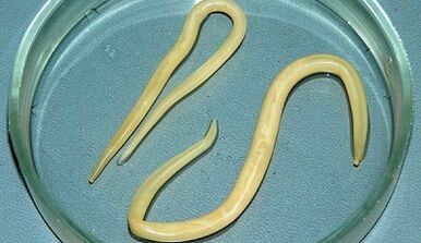 Ako správne vykonávať testy na ascariázu