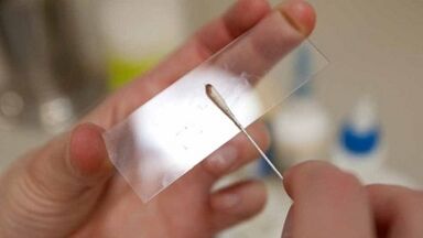 Analýza Calais na identifikáciu parazitov