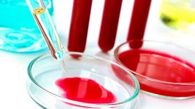 Krvný test na parazity