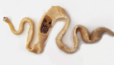 Ako objaviť prítomnosť parazitov v tele