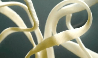 Ako odstrániť parazity z ľudského tela